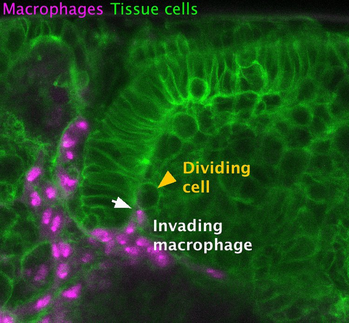 Immune cells enter tissues