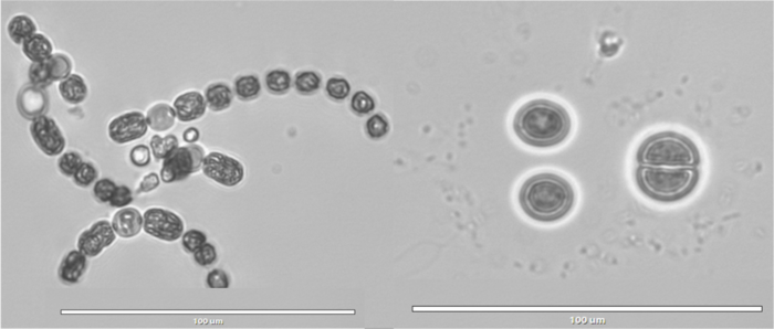 Cyanobacteria [IMAGE] | EurekAlert! Science News Releases