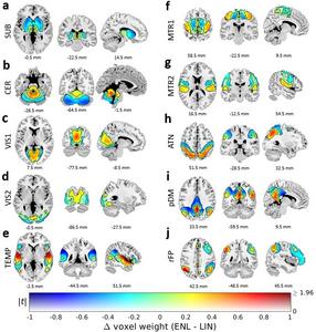 Georgia State Researchers Uncover New Ways to Identify Signatures of Mental Disorders Using fMRI Scans Georgia State Researchers Uncover New Ways to Identify Signatures of Mental Disorders Using fMRI Scans