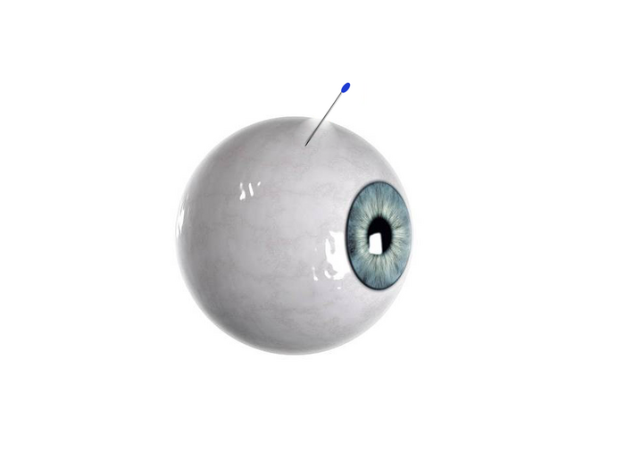 Self-Plugging Microneedle for [IMAGE] | EurekAlert! Science News Releases