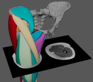 Cross-section of the polygonal muscle modelling approach