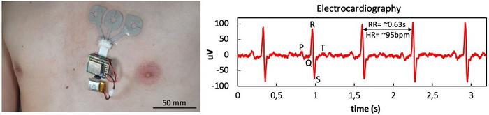 Electrophysiology patch [IMAGE] | EurekAlert! Science News Releases