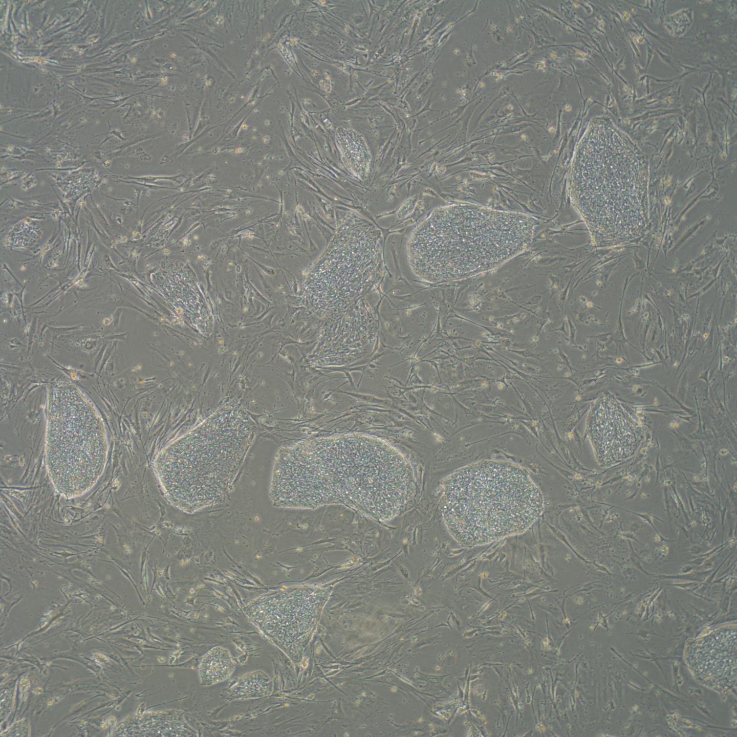 Prader Willi Stem Cells