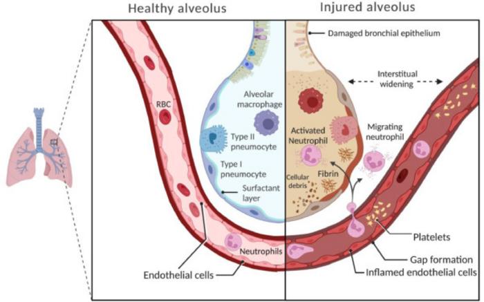 An acute respiratory distress syndrome drug development collaboration stimulated by the Virginia Drug Discovery Consortium