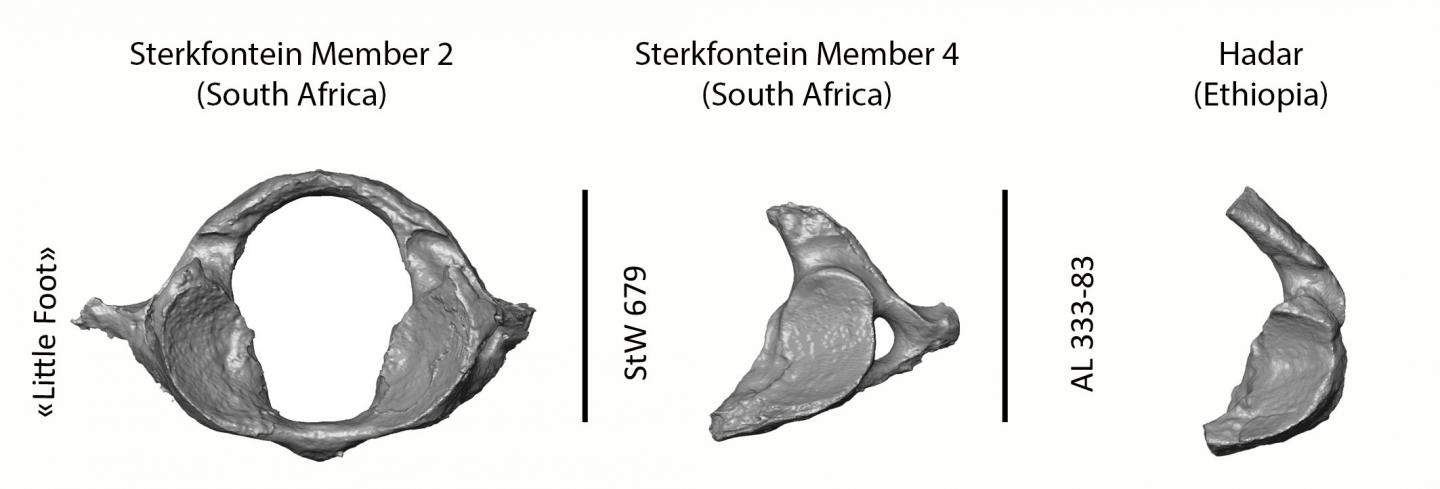 Vertebra Comparison