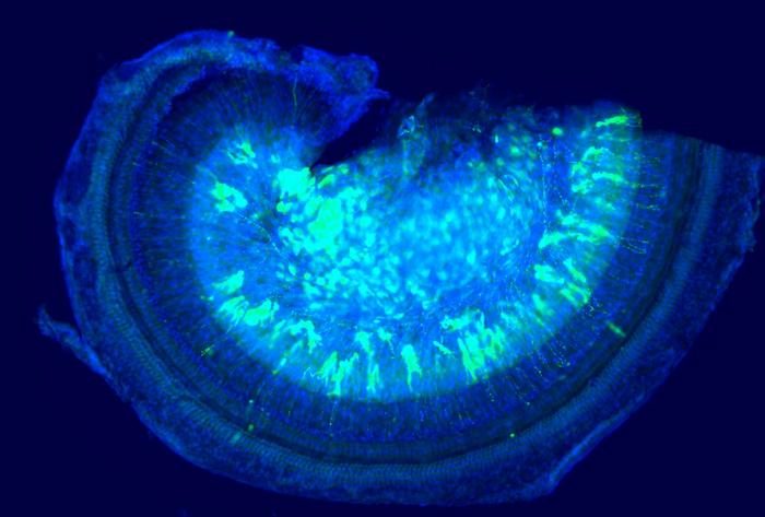 Images show part of the uncoiled mouse cochlea, after treatment with the gene therapy (green). In pink, the all important sensory hair cells can be seen, preserving hearing in mice with Norrie disease.