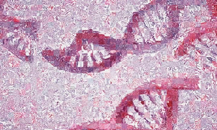 DNA Mosaic