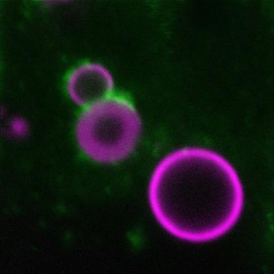 Composition of Calcium-Based Deposits in the Eye
