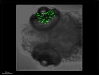 Green Retinoblastoma Cells