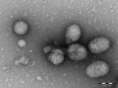 Electron Microscope Image of the Ferak Virus