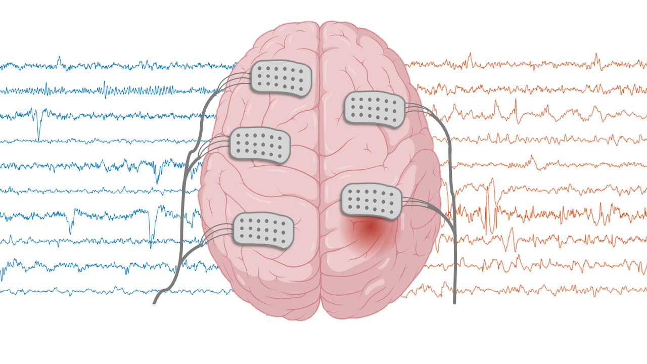 Signals shown from the database that was used in the study