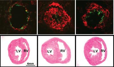 Impact of HDL Peptide 4F on Pulmonary Hypertension