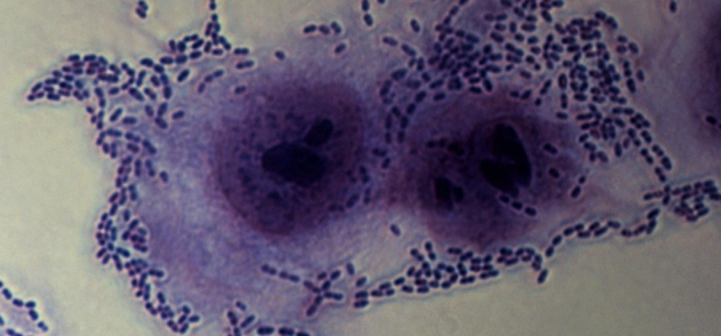 Bacteria Sticking to a Lower Airway Cell