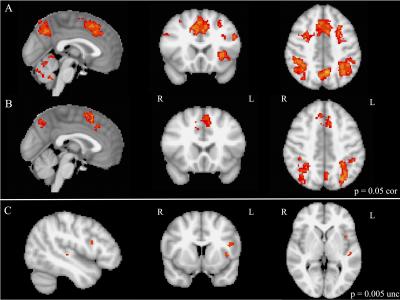 Functional MRI Imaging During Mental Task Switching