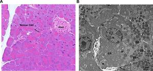 Histology of endocrine and exocrine pancreas and ultrastructure of exocrine acinar cells.