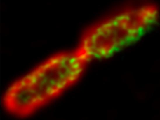 Gram-negative Bacteria