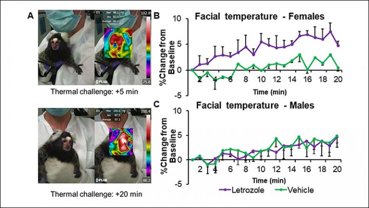 Thermoregulation