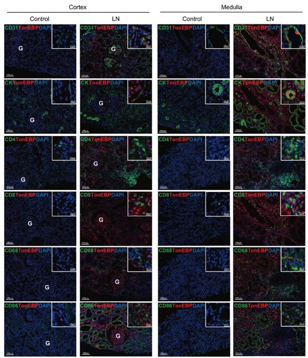 TonEBP expression in endothelial cells, epithelial cells, and infiltrating immune cells in renal biopsy tissues subjected to multiplex immune fluorescence staining.