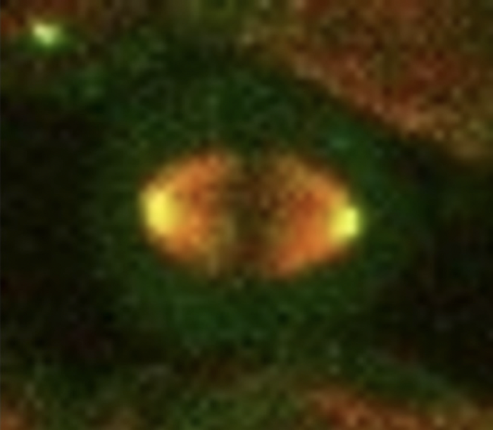 Spindle apparatus during mitosis in a human colon cancer cell