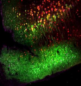 α-synuclein spread in the mouse brain.