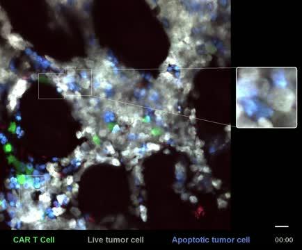 Intravital Imaging of a CAR T Cell in Action