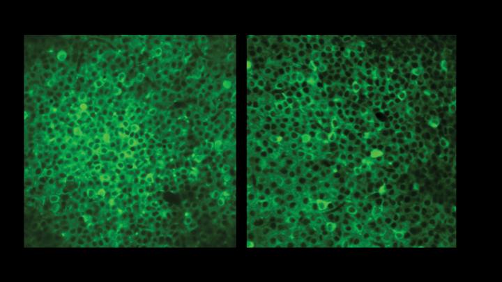 Wildtype vs. Schizophrenia Activity