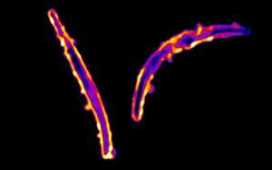 Plasmodium falciparum sporozoites