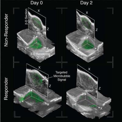 3-D Ultrasound Molecular Imaging (USMI) Images