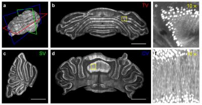 Micron-scale Neuroanatomy in the Whole Cerebellum