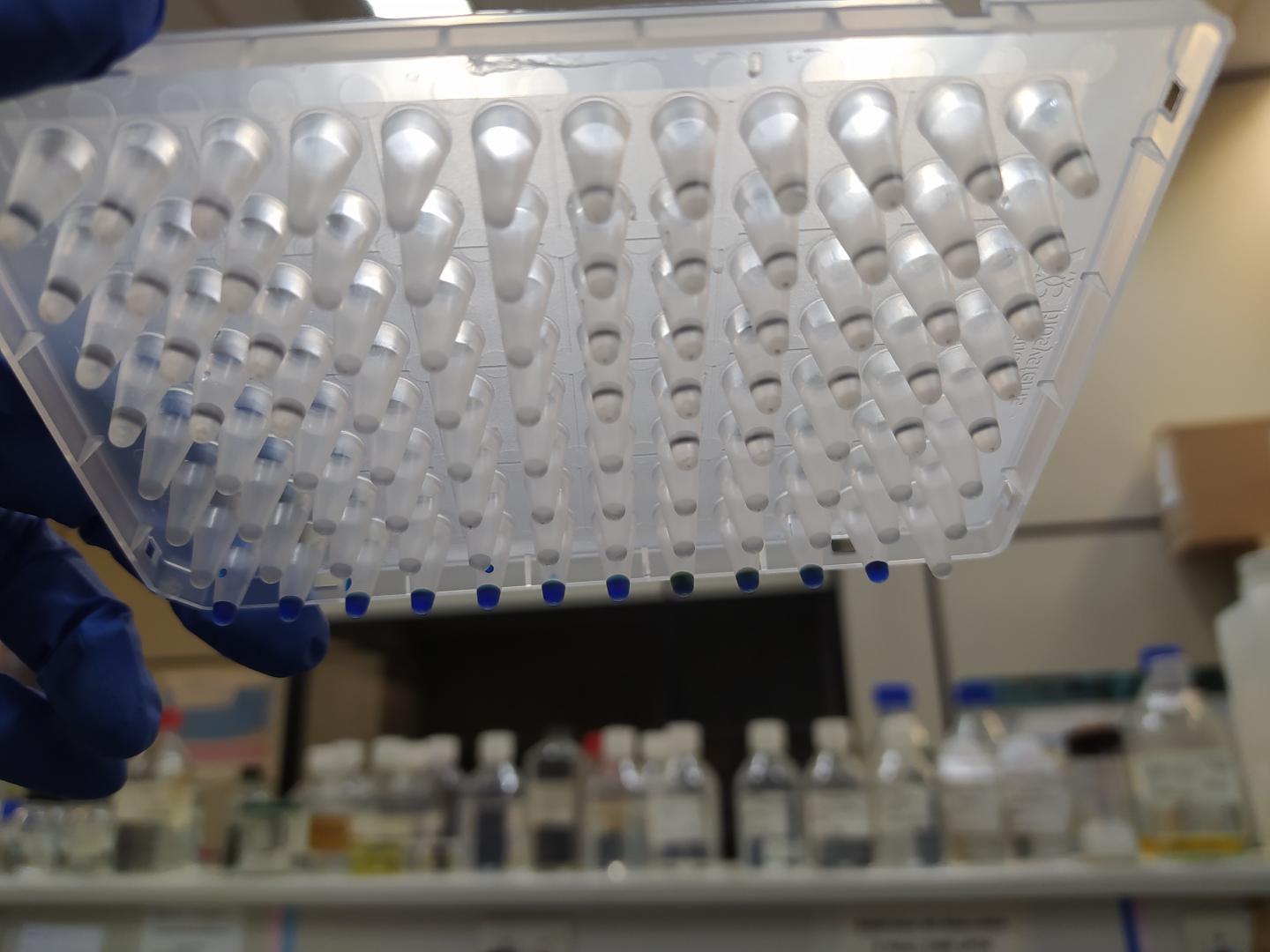 COVID-19 Diagnostic Test