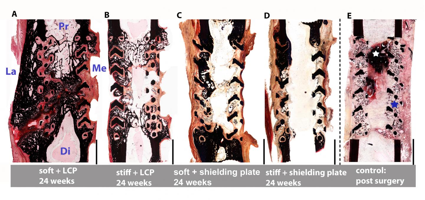 Soft Titanium Scaffolds Help Heal Large Bone Defects (3 of 3)