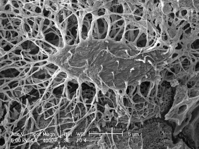 Mouse Osteocytes in Bone