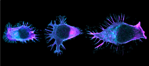 Migrating human T lymphocytes revealing a broad protrusion at the leading edge and long adhesive protrusions at the rear.