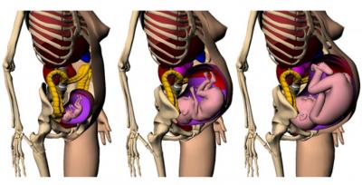 Safer, More Accurate Radiation Therapy for Expecting Mothers
