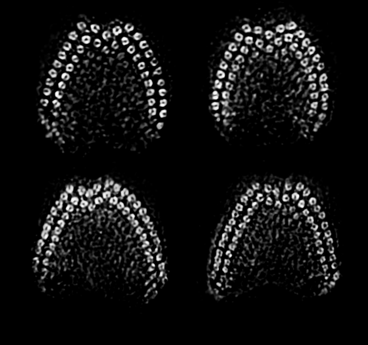 Spectrin Proteins Are a Crucial Anchor in Hearing (1 of 2)