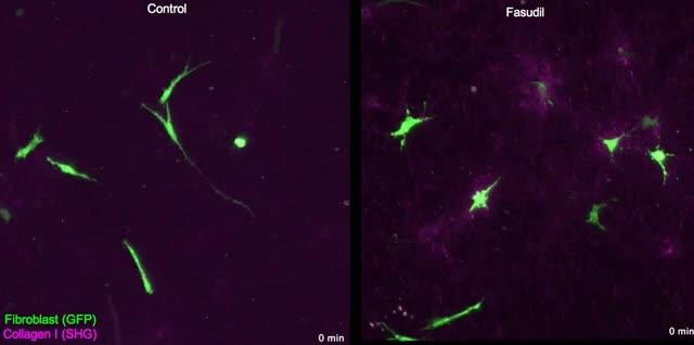 'Relaxing' Tense, Tumor-Filled Tissues Makes Chemotherapies More Effective (2 of 6)