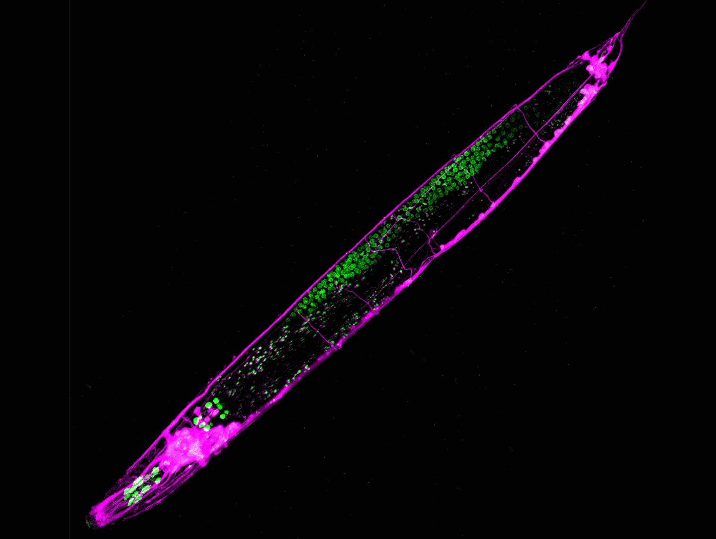 <i>C. elegans</i> Neurons and Germ Cells