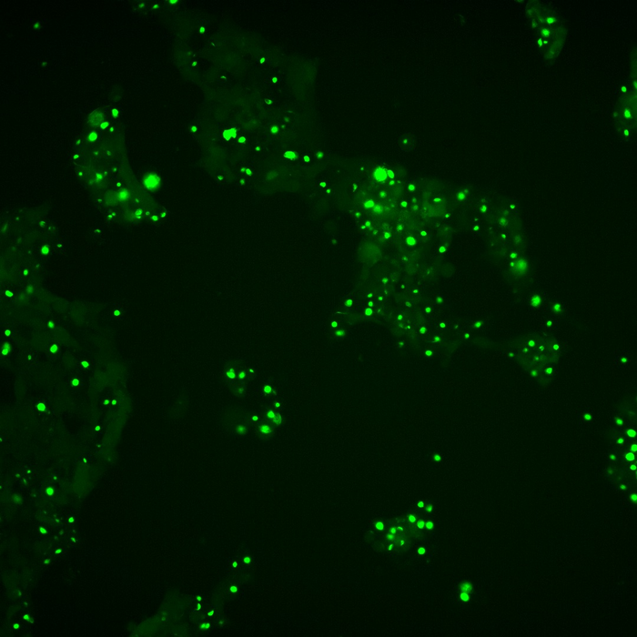 Protein misfolding