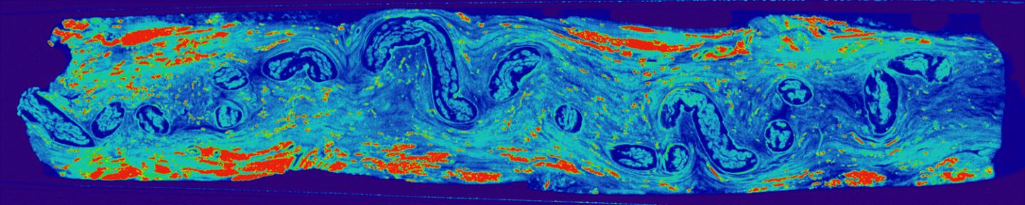 MicroCT Scan of VGB Nerve