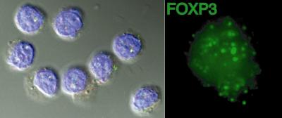 Attacking Autoimmunity