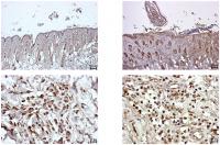 Immunohistochemical staining of PD-L1