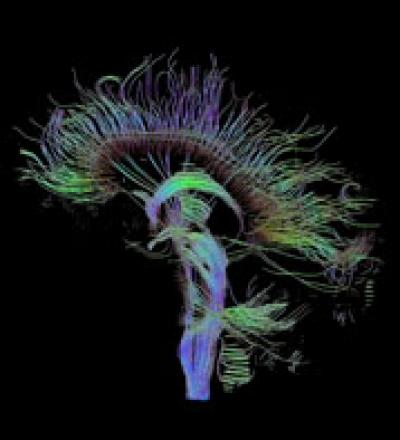 Diffusion Tensor Imaging Data Reconstructing the Fibres That Connect the Different Parts of the Brai