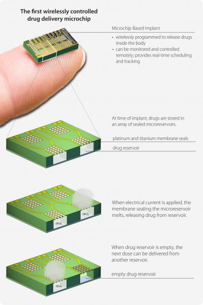 Implantable Microchip Delivers Osteoporosis Medicine (3 of 4)