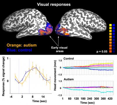 Autistic Adults have Unreliable Neural Responses (2 of 3)