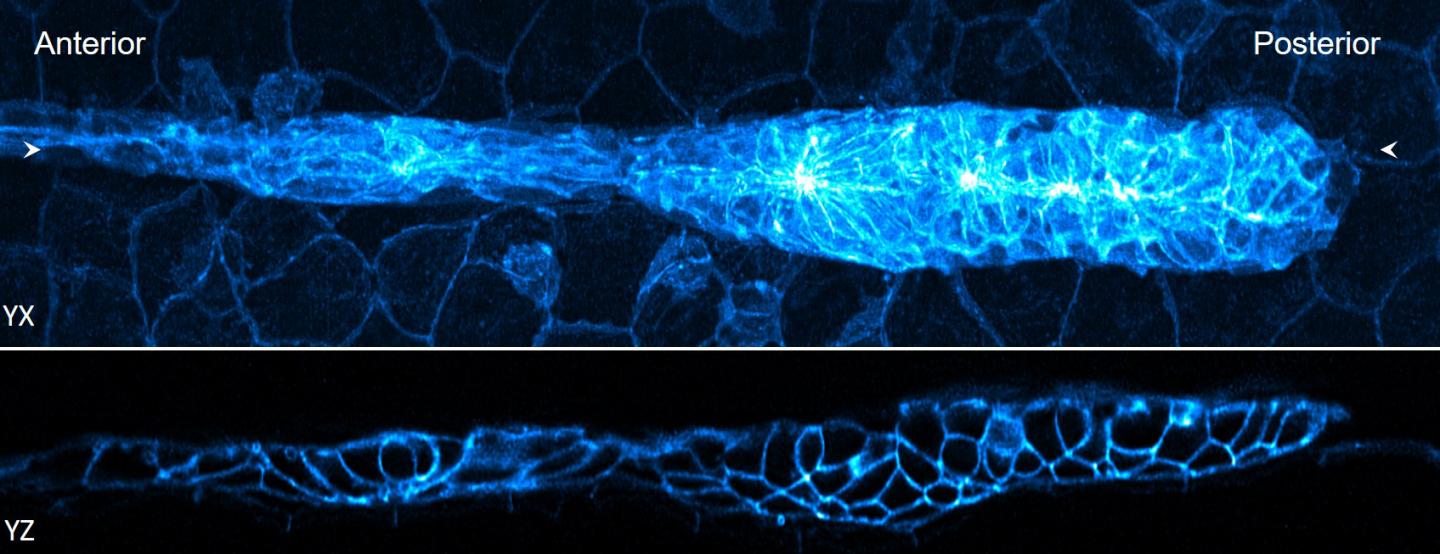 Fluorescence Imaging of a Zebrafish Embryo