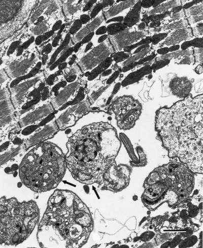 <I>T. cruzi</I> parasite