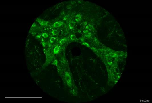 Colon Neurons Talking