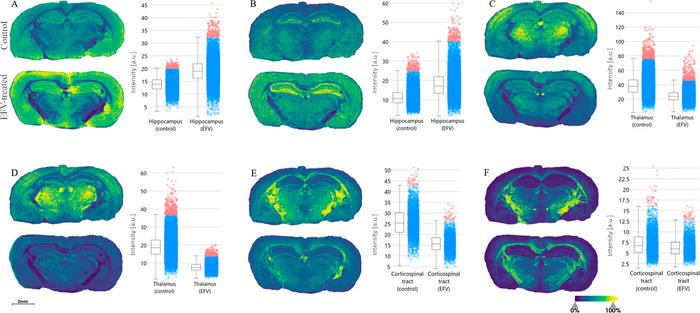 HIV drug Efavirenz alters lipid metabolism in the brain