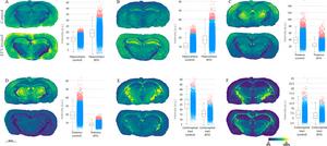 HIV drug Efavirenz alters lipid metabolism in the brain