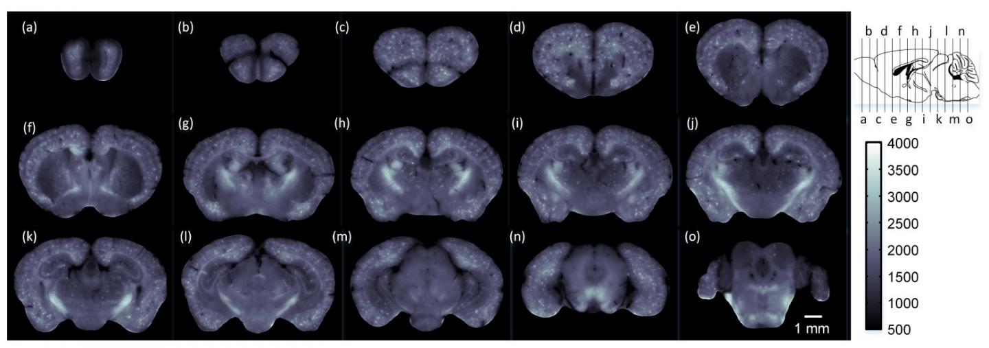 Brain-wide Map of Senile Plaques